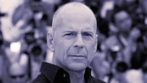 Are bald men more virile?