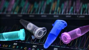 DNA analysis (Copyright: SPL)