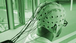 Will we ever have cyborg brains?