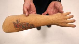 Will we ever regrow limbs?
