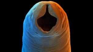 Worm therapy: Why parasites may be good for you