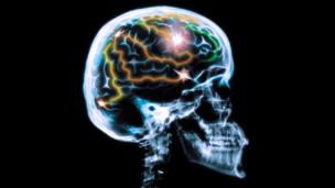 Simpler solutions for unlocking secrets of ageing minds