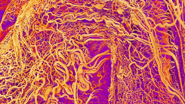 Blood vessels (Copyright: SPL)