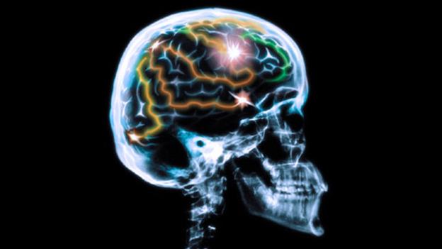 Simpler solutions for unlocking secrets of ageing minds