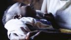 Baby with HIV