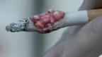 Cigarette with tumour image