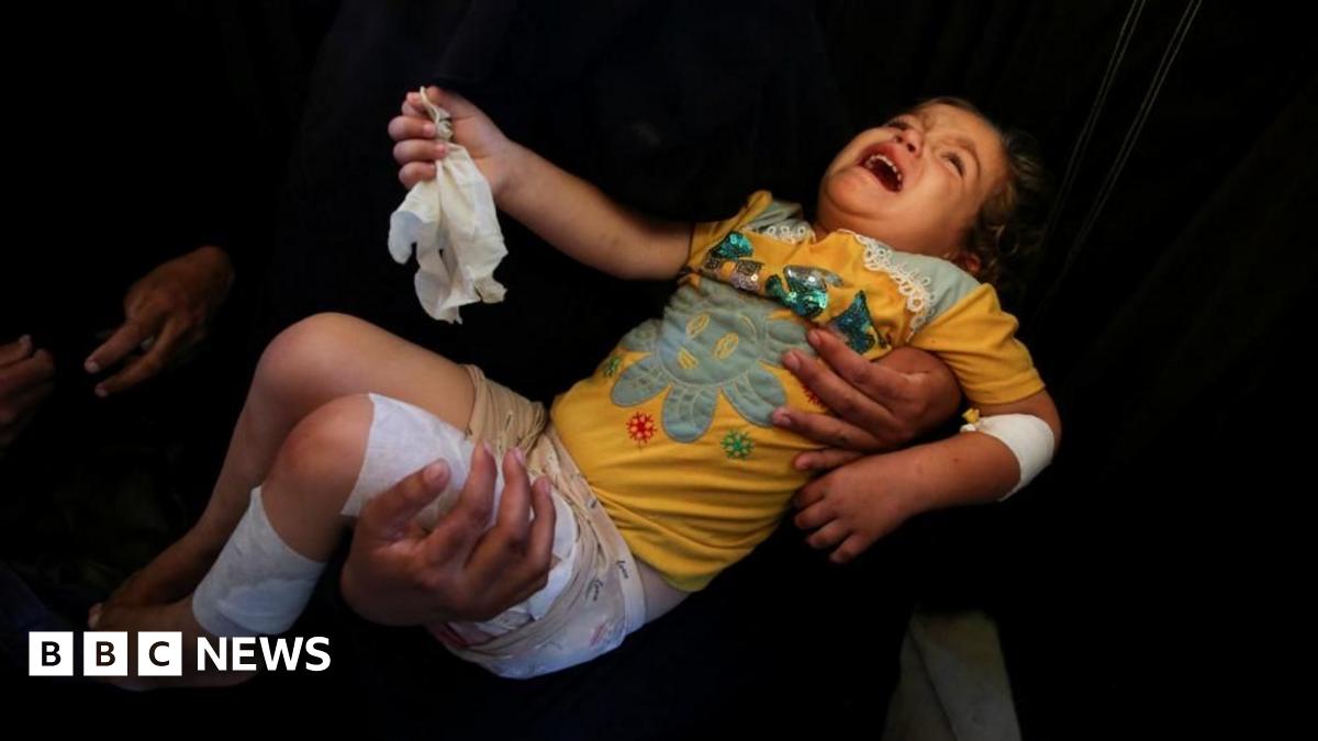 Government plans to bring more Gazan children to UK for treatment