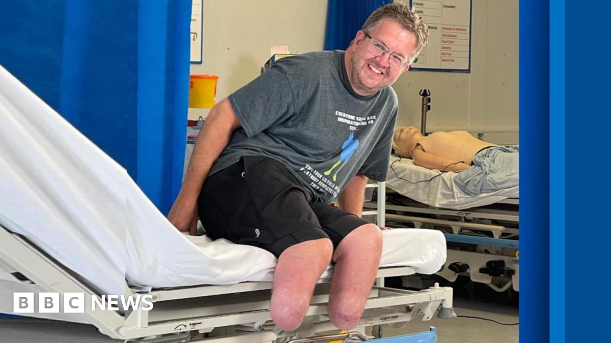 Neil Hopper is sitting on the side of a hospital bed wearing a grey T-shirt, black shorts and glasses. He is not wearing prosthetic limbs so his bilateral leg amputations are on show. He is smiling at the camera.


