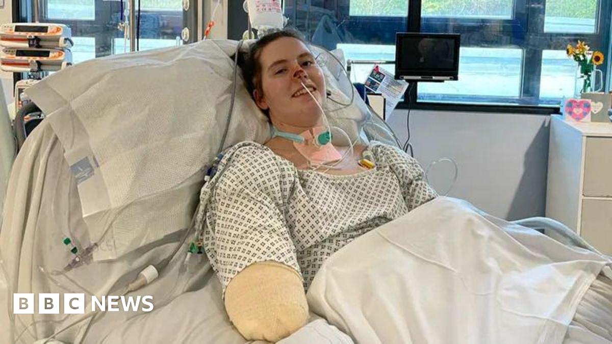 カーディフの医学生は、4つの手足をすべて敗血症のショックに失います