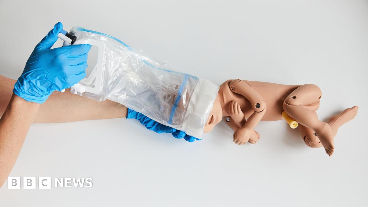 The OdonAssist being used on a baby replica doll. A person wearing blue gloves is using the device which has a plastic handle with a soft plastic extension which is sitting around the baby's head.
