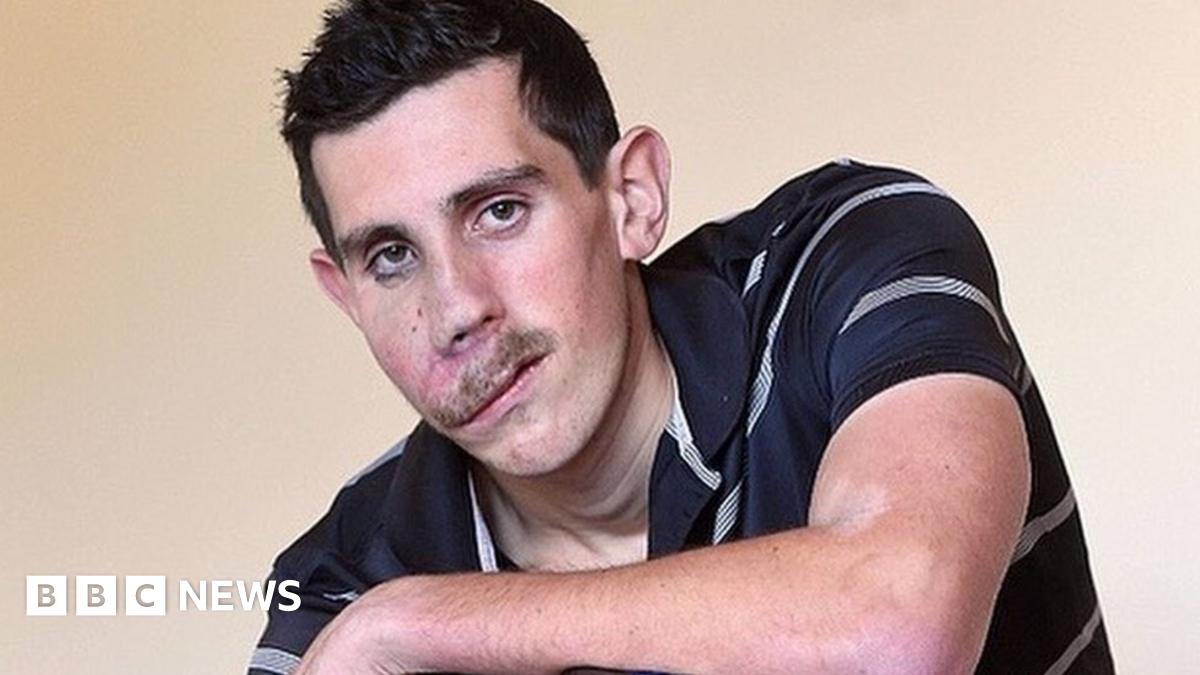'People stared and laughed and I don't want others to go through that ...