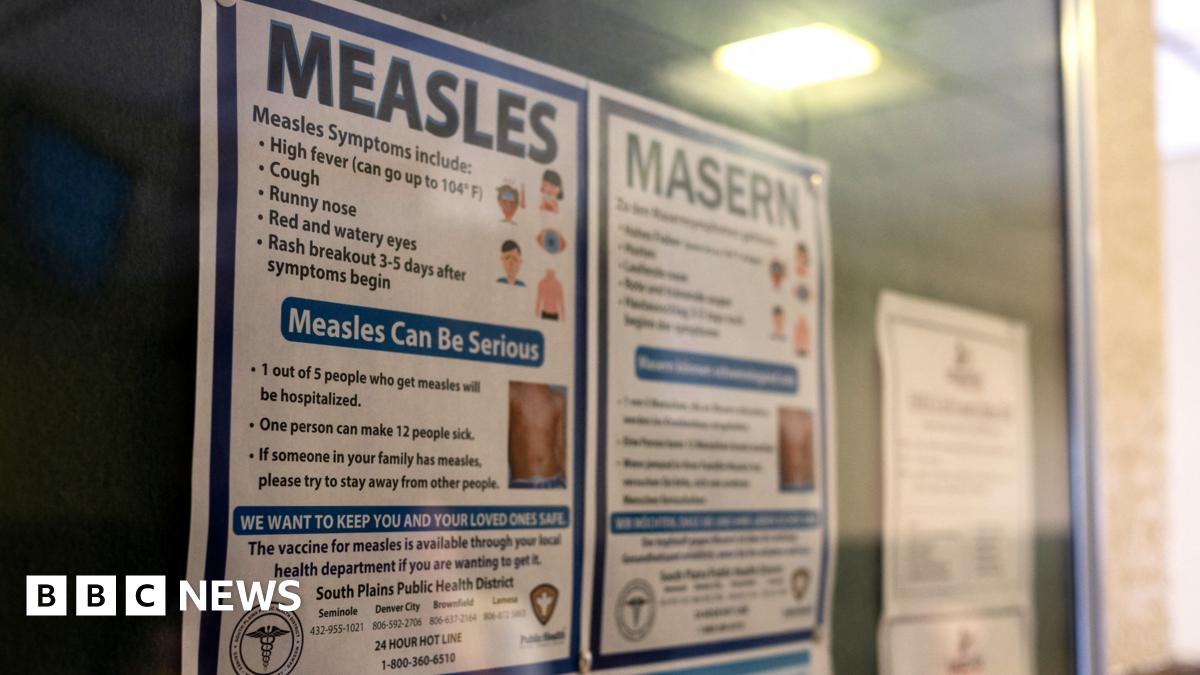 Second child dies of measles as western Texas outbreak worsens