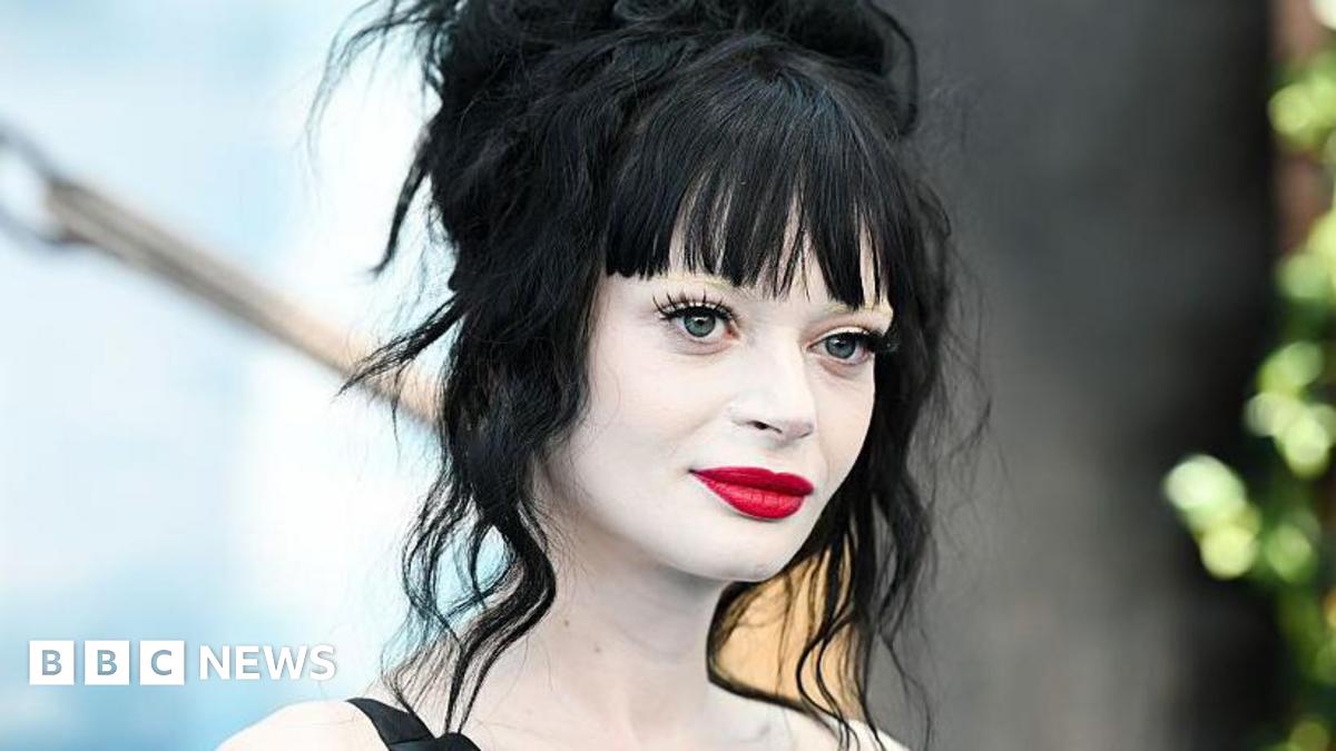 
                            Celebrity Traitors star Ruth Codd recovering after second leg amputation