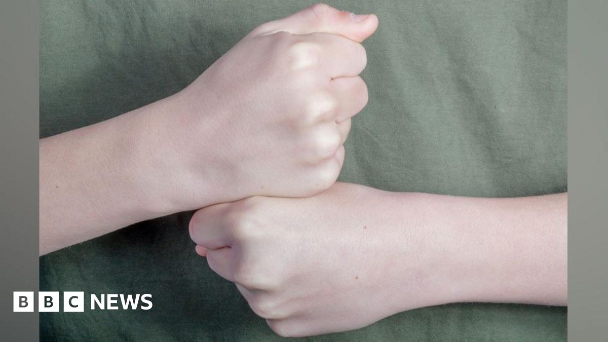 Story of sign-language educated pair 'remarkable'