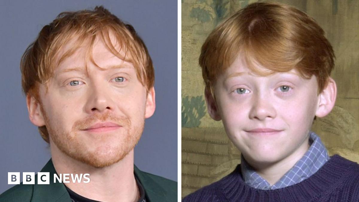 
                            Harry Potter star Rupert Grint: 'I'll never leave Ron's shadow'