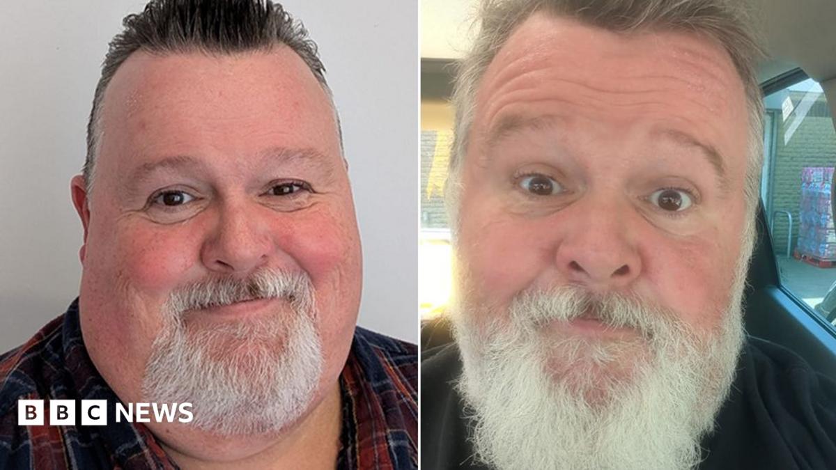 Why don't men talk about using weight-loss drugs?