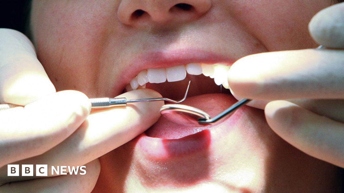 Dentists 'shocked and frustrated' by number of NHS no-shows
