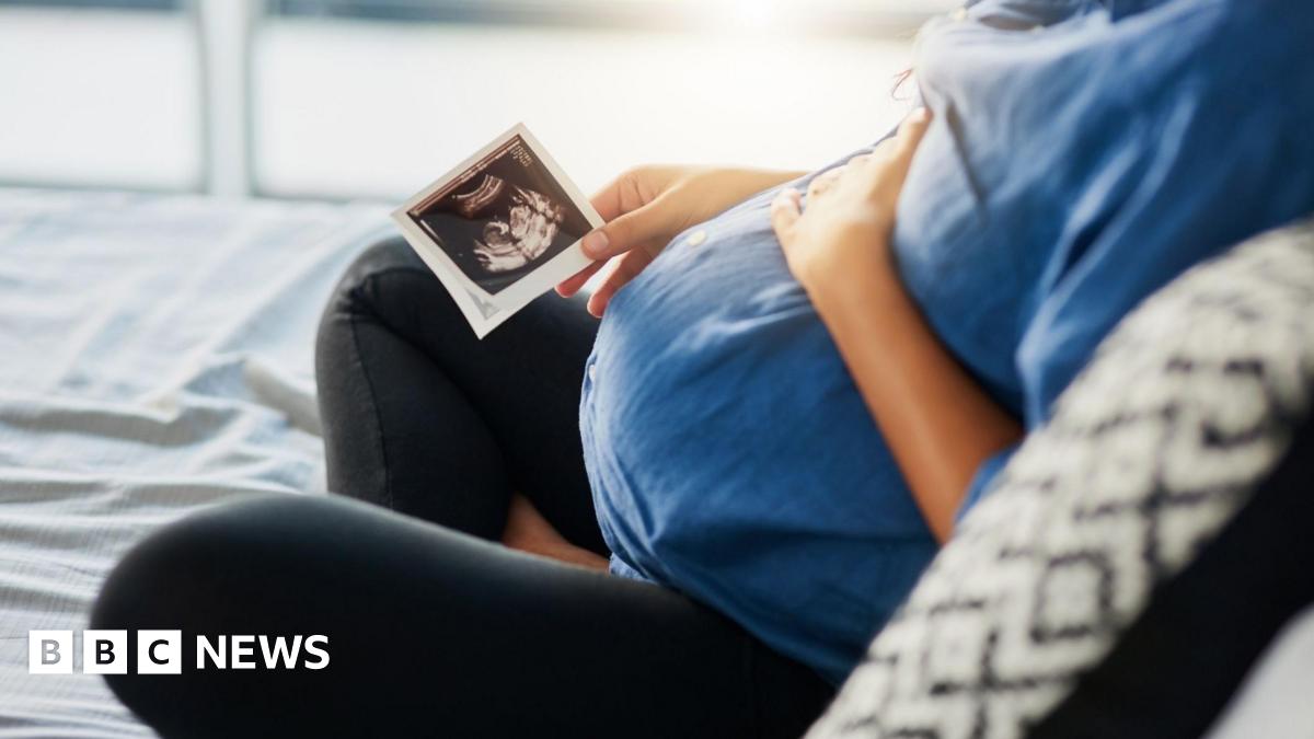 Pregnant woman holding an image from an ultrasound scan.