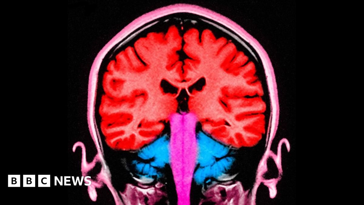 Brain stimulating test makes people 'less selfish'