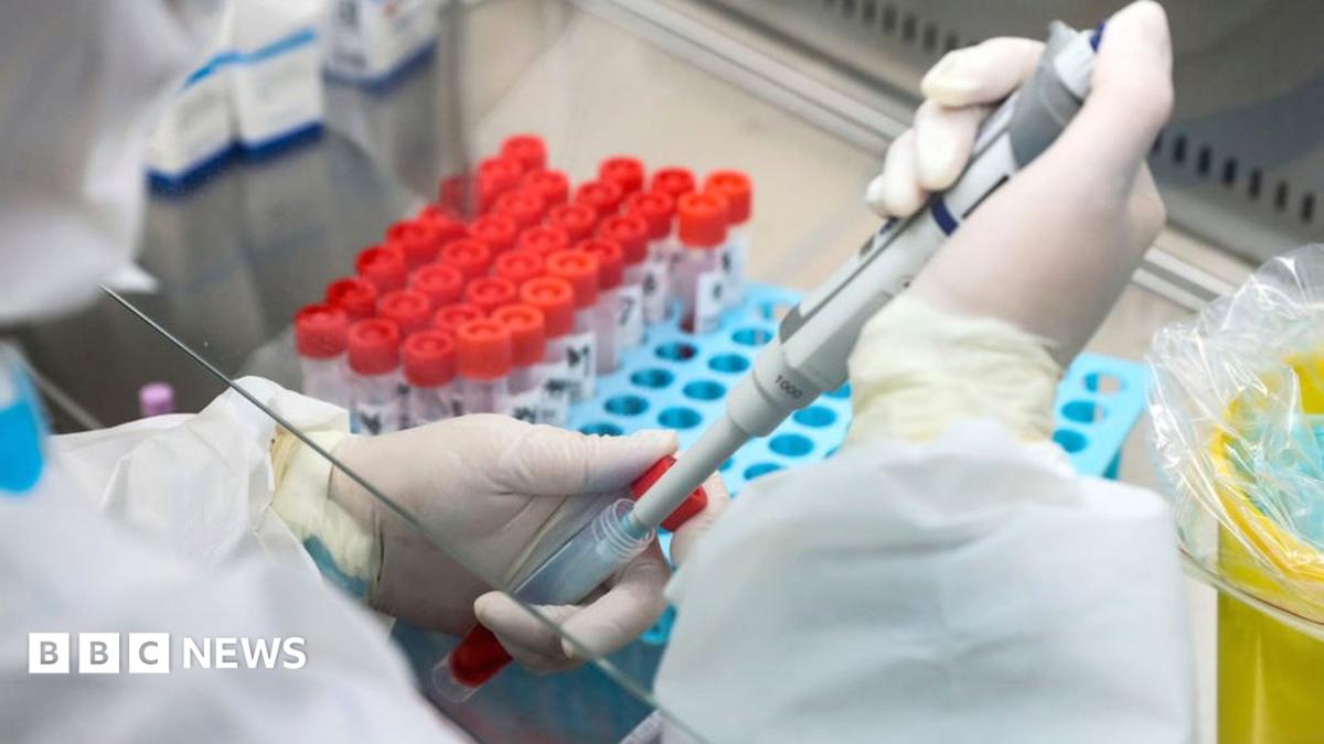 Covid in Scotland: Action call over testing lab jobs threat - BBC News