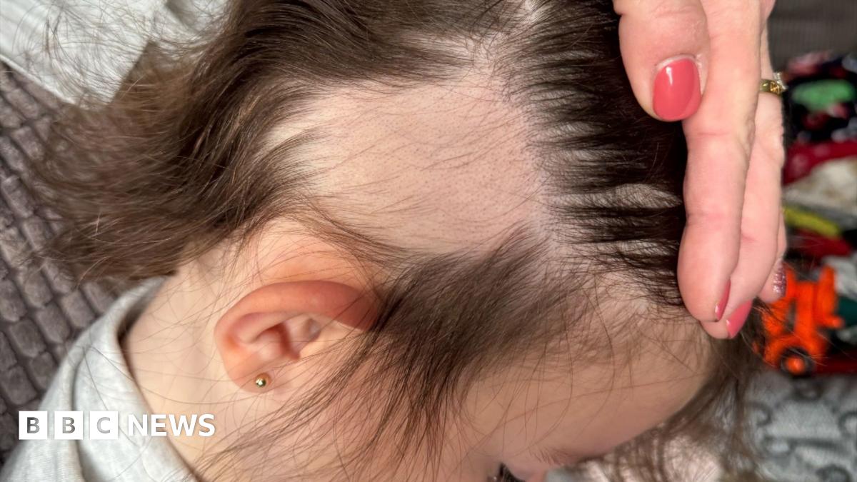 Mum's warning after Temu brush rips out child's hair - BBC News