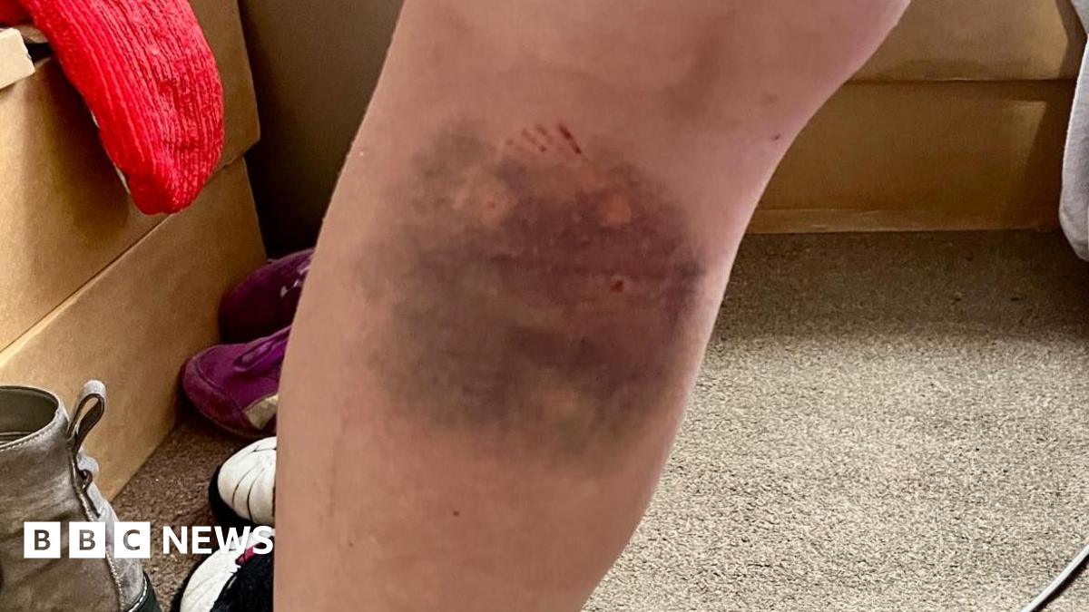 Plea to Kendal dog owners after delivery driver attacked
