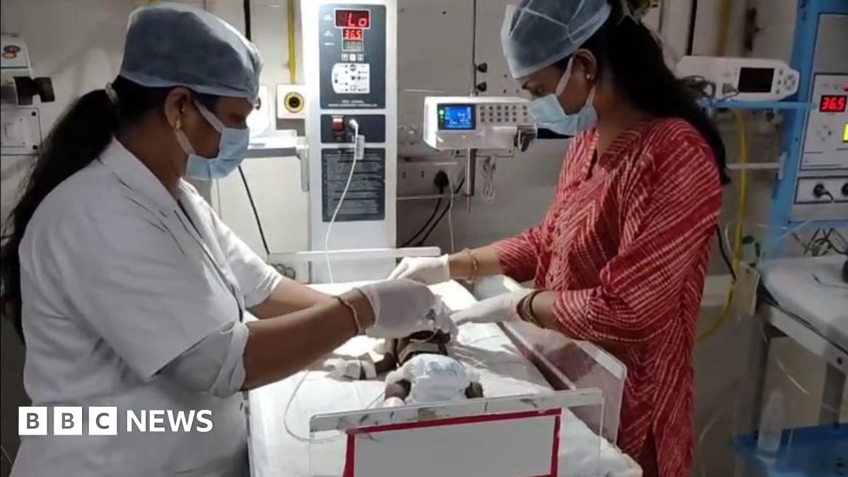 Uttar Pradesh Newborn baby buried alive in India fights for her life