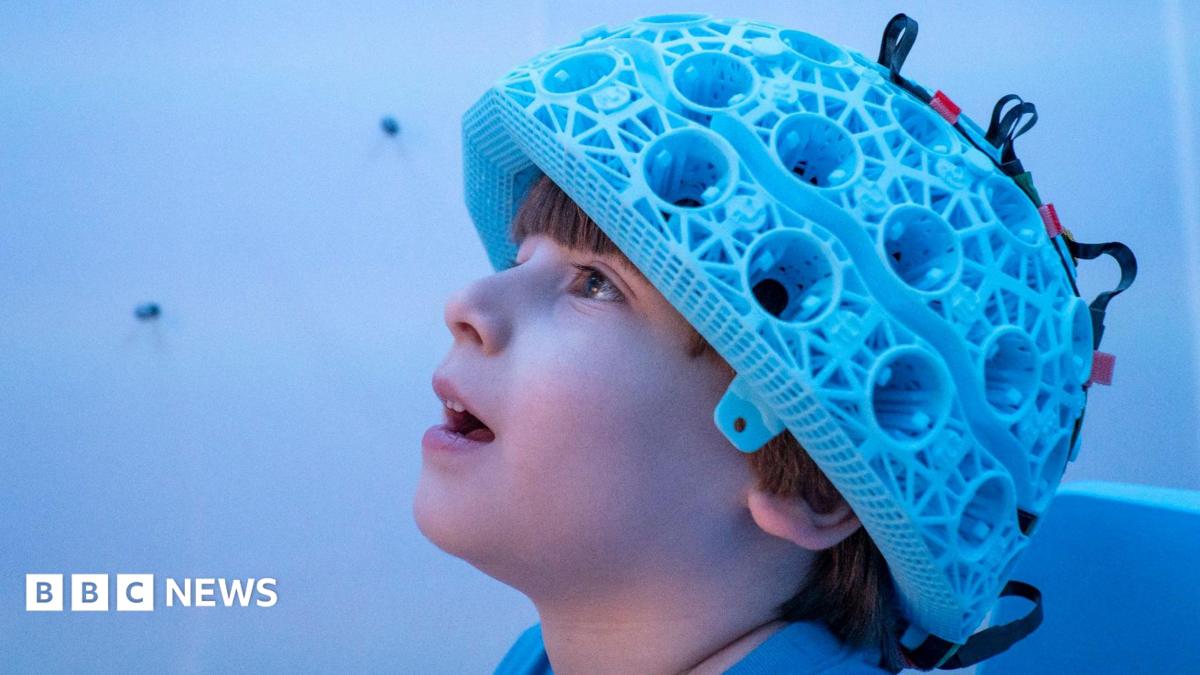 New scanner 'gives clearest picture yet of children's brains