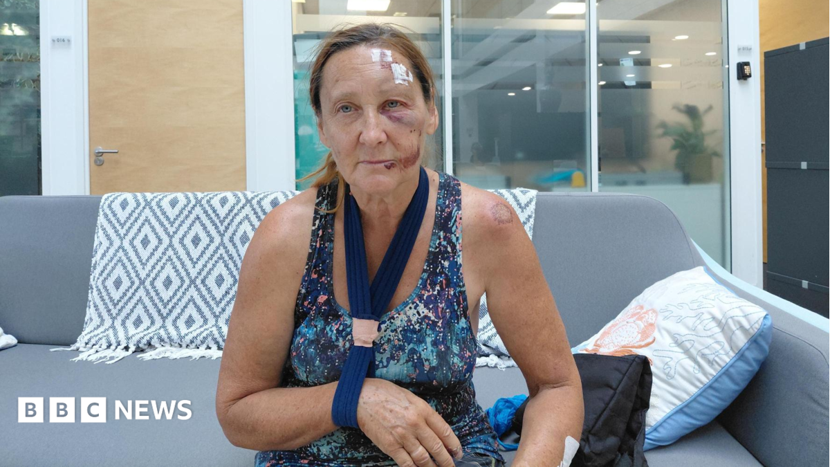Reading cyclist hit by e-scooter rider left with serious injuries