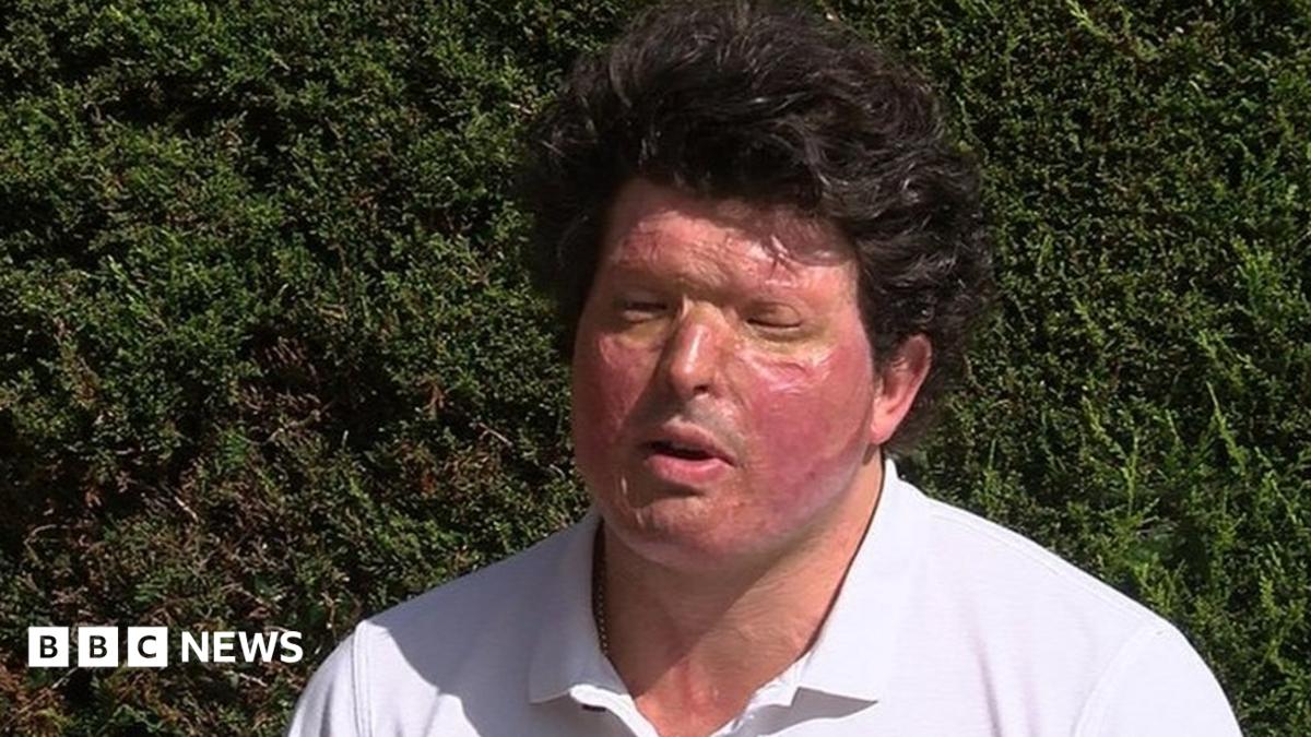 Truro acid attack victim Andreas Christopheros calls for law