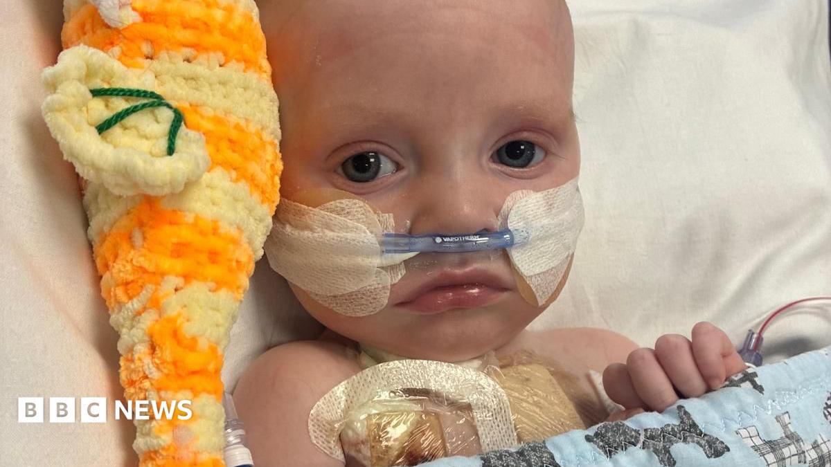 Baby whose parents feared had just days to live is 'thriving' after life-saving heart operation
