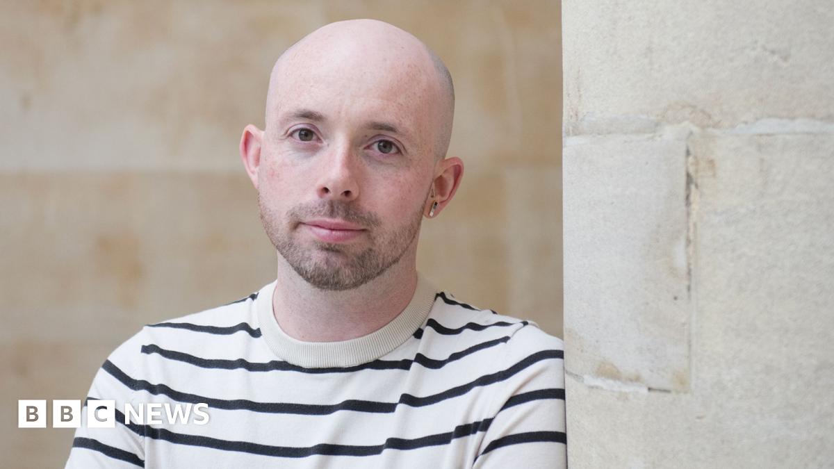 Hair transplants, finasteride and hair systems: Welcome to the world of hair restoration