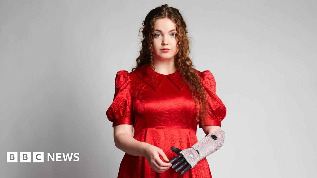 
                            Bridgerton actor was told her disability would hold her back before Netflix role