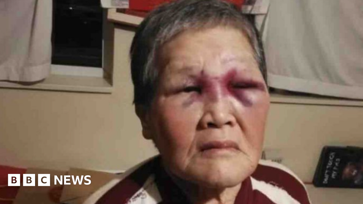 Chinese granny who fought off attacker in US praised for bravery - BBC News