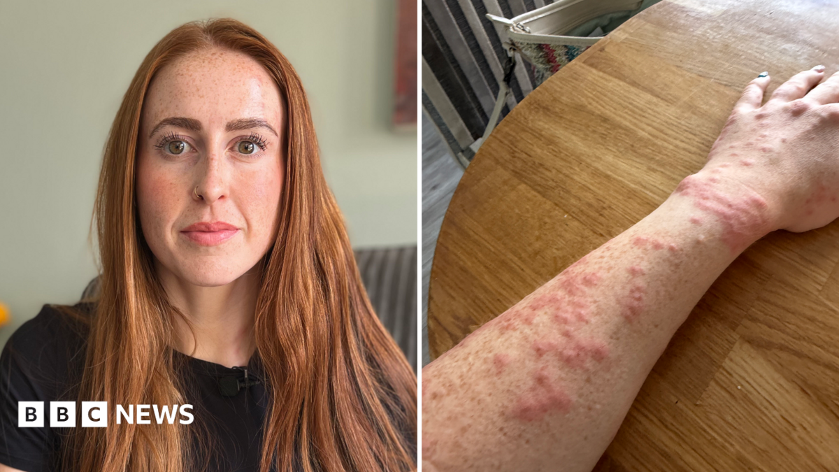 Woman attacked by bed bugs during Travelodge stay