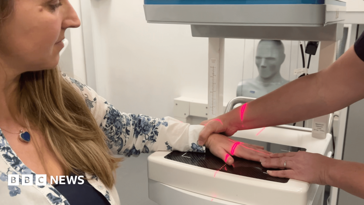 エクセターの女性、早期関節炎診断のための3Dスキャンを初試験