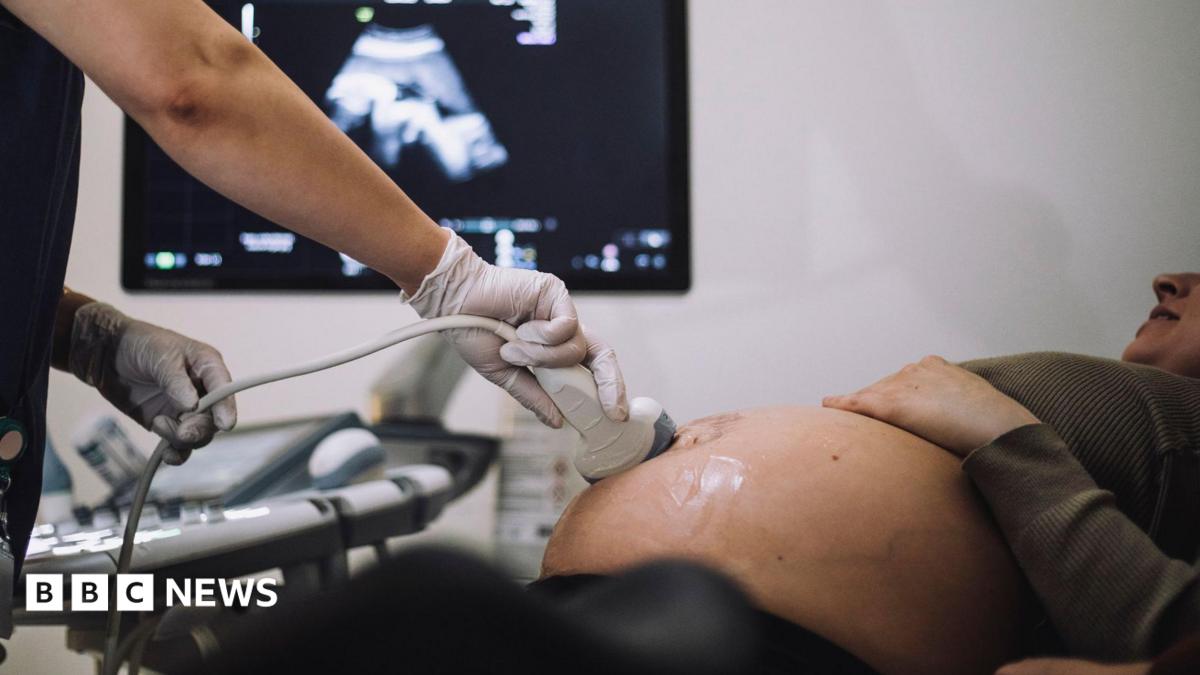 'Normal birth drive' criticism removed from maternity report, expert claims