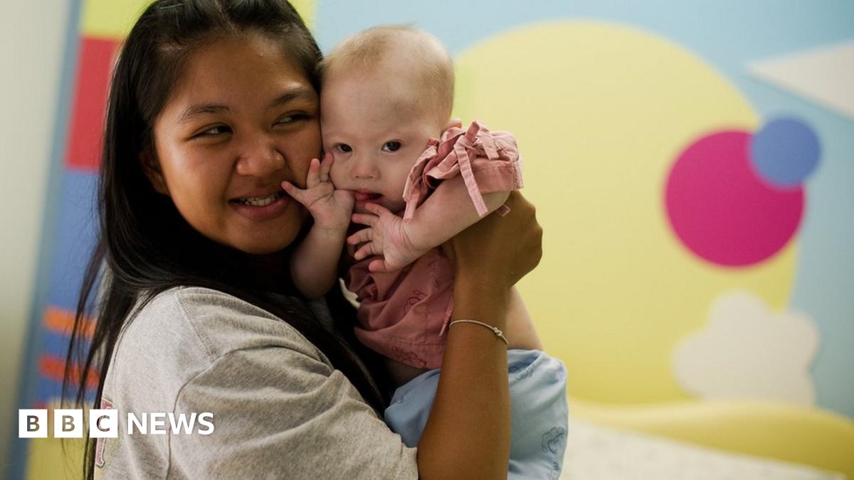Pattaramon Chanbua with baby Gammy, who was born with Down's syndrome