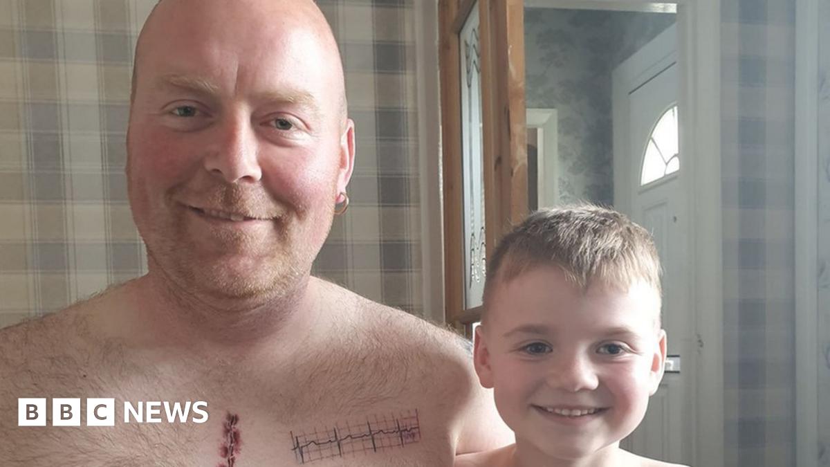 East Yorkshire father gets surgery scar tattoo to support son BBC News