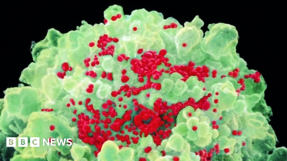 HIV: First woman in world believed to be cured of virus - BBC News