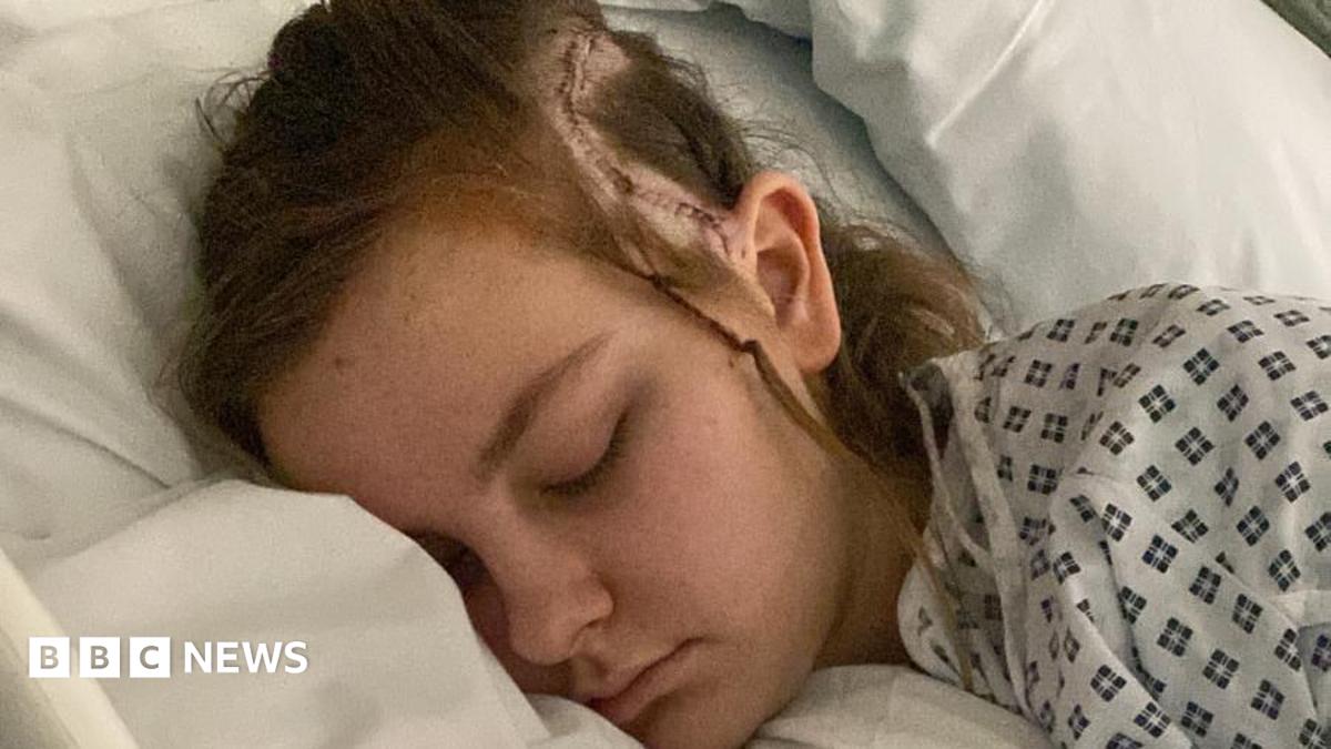 Girl, 15, 'youngest' to have conscious brain surgery for condition