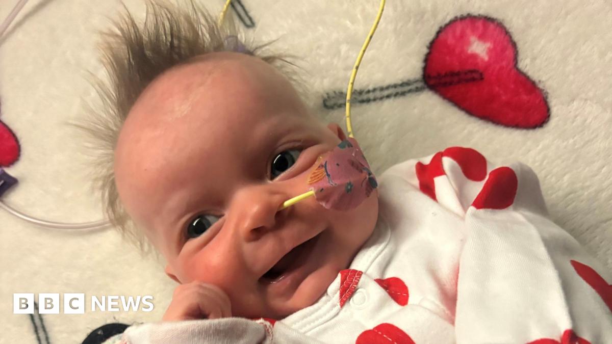 A young baby wearing a white babygrow with red hearts on it smiles at the camera. The baby has a yellow hospital tube coming out of her nose and has wispy brown hair. 