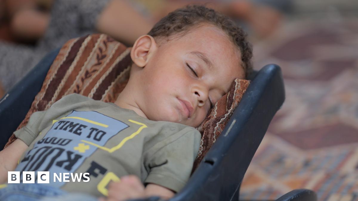 An 11-month-old is suffering from polio in Gaza, the first case there in 25 years