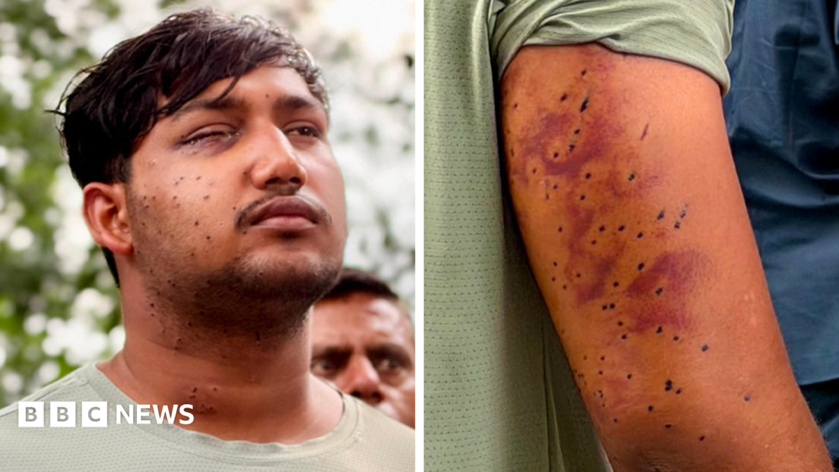 India's 'cockroach' protesters have wounds consistent with pellet-gun fire, say experts