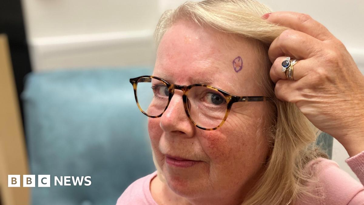 Faster Skin Cancer Diagnosis in Nottinghamshire Thanks to 'Picture of Health' Technology