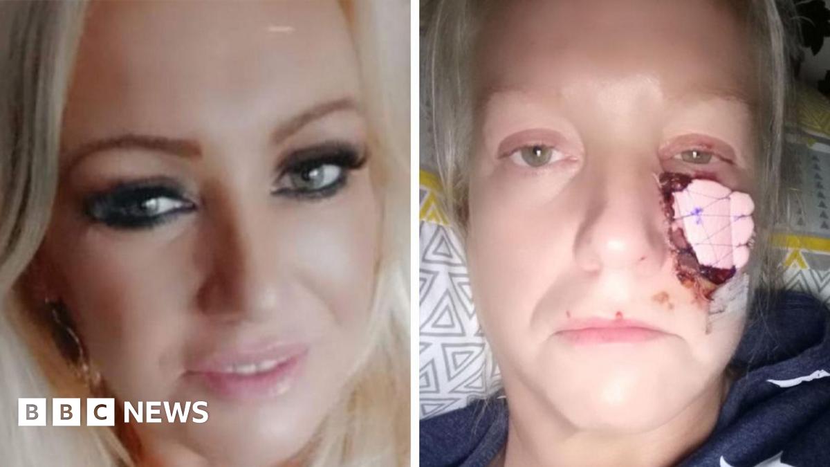 Kelly Allen before and after the dog attack
