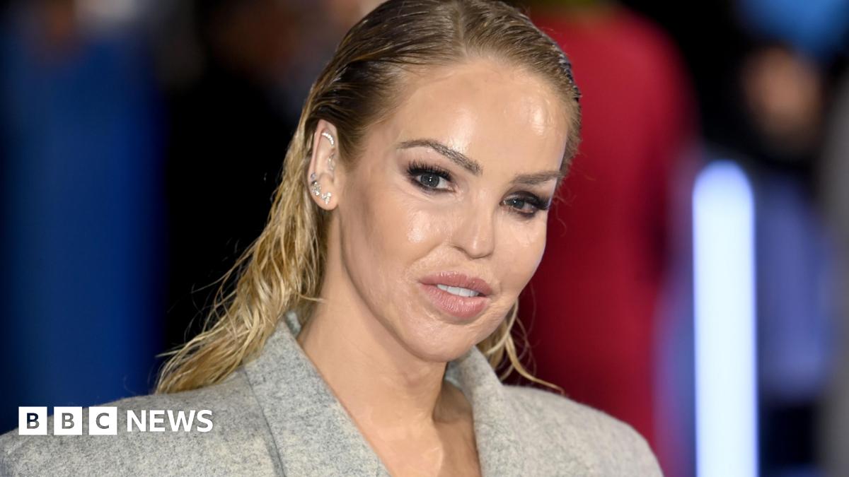 Katie Piper Receives Artificial Eye 16 Years After Acid Attack: A Journey of Resilience