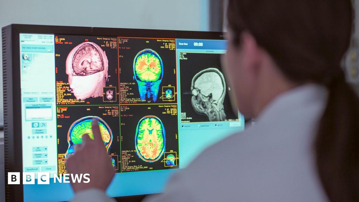 
                            Four pivotal ages in your brain's development revealed in new scientific study