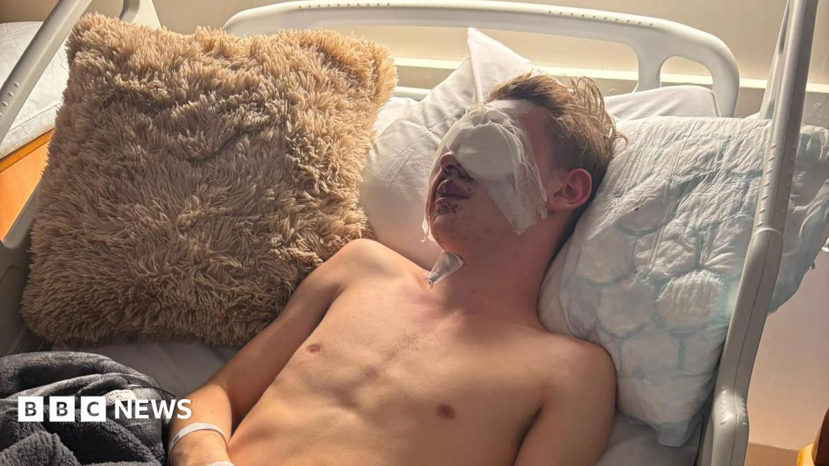Teenager blinded by firework calls for ban on public sales