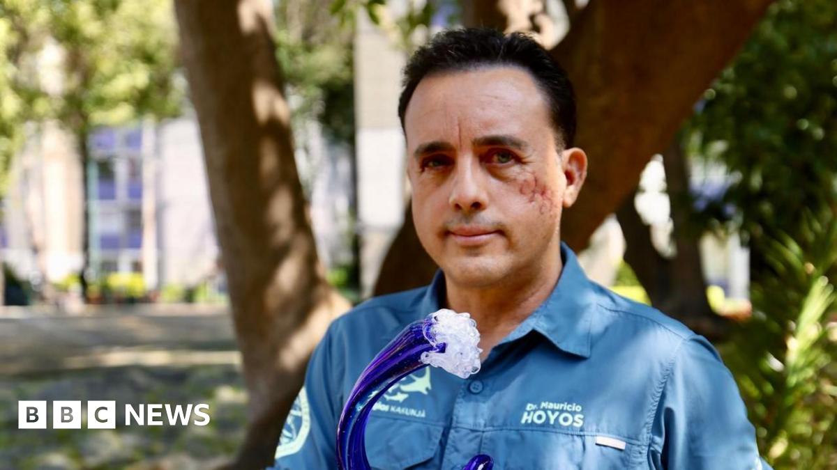 
                            Biologist bitten in head by shark hopes to meet animal again